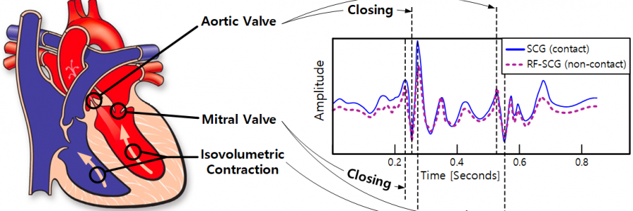 Contactless Seismocardiography via Deep Learning Radars